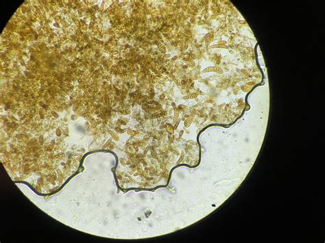 The spores develop into female and male gametophytes, and fertilisation leads to the development of microscopic sporophytes that grow to adult size (Kain 1979). For any seaweed species grown through sexual reproduction, optimising hatchery production processes is crucial to the success of sea farming.. 