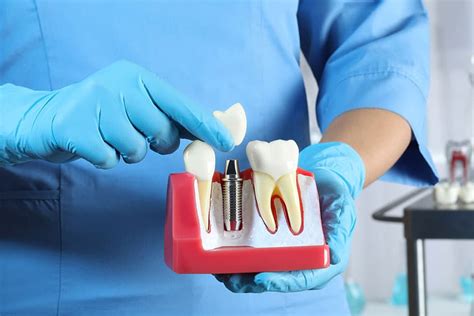 Dental work tends to be expensive, partially because the procedures take a lot of time and may require more than one visit. Medical insurance plans don’t usually cover dental visits and procedures, and you may not be able to afford separate.... 