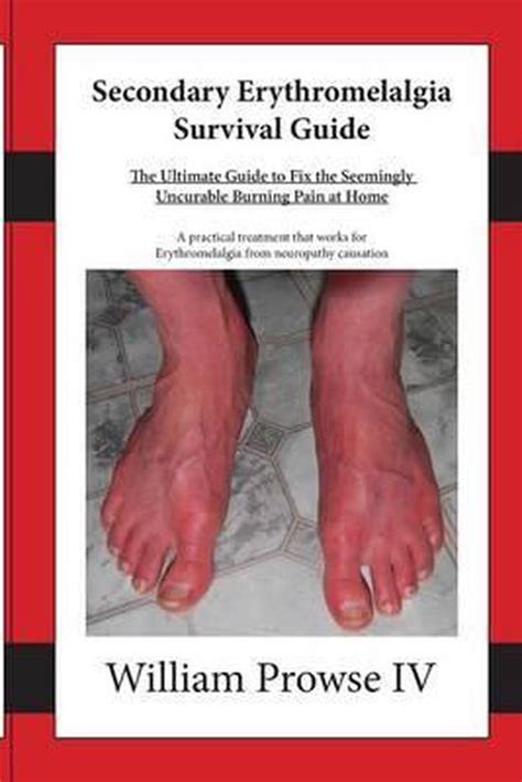 Secondary erythromelalgia survival guide by william e prowse iv. - Patrick rothfuss doors of stone release.