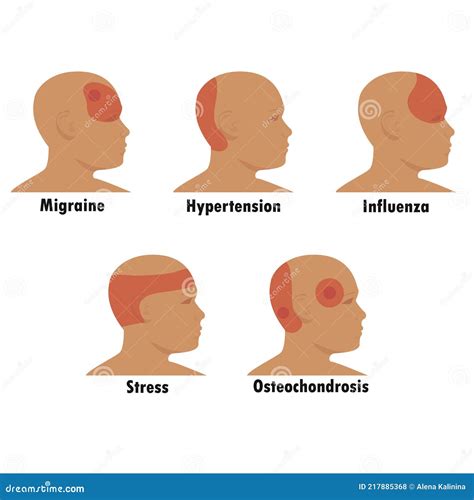 Sections of brain where headaches are from