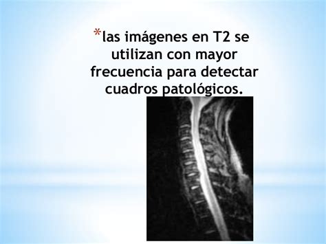 Secuencias t1 y t2 - SlideShare