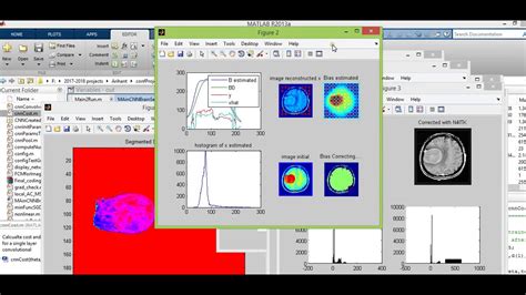 Segmentation For Tumor Matlab Code