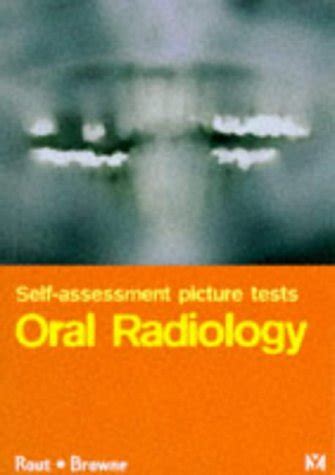 Full Download Self Assessment Picture Tests In Dentistry Oral Radiology By P G John Rout
