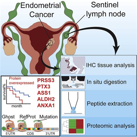 Sentinel Lymph Node Mapping in Endometrial Cancer: An Update