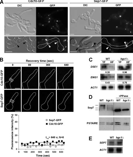 Sep7 Is Essential to Modify Septin Ring Dynamics and Inhibit Cell ...