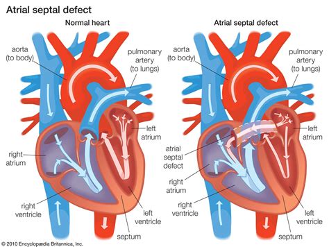 Septum of the heart Function defects and more