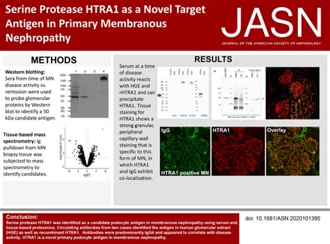 Serine Protease HTRA1 as a Novel Target Antigen in …