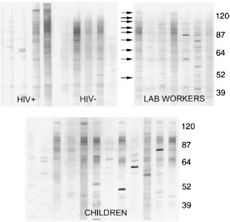 Serologic Evidence for Cryptococcus neoformans Infection in …