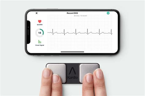 Setting Up the AliveCor KardiaMobile EKG Recorder