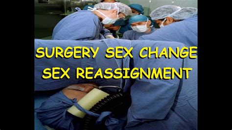 Sex Reassignment Surgery or SRS