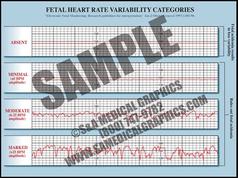 Sex differences in fetal heart rate and variability assessed by ...