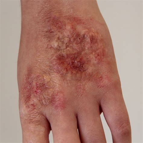 Sfx burns.  Search & filter our sound effects app to easily find the ...