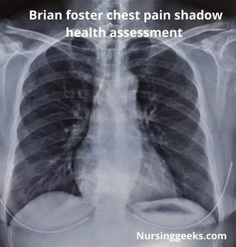 Shadow health focused exam chest pain subjective. Chest Pain focused Assessment Subjective Pt. reports: "I have been having some troubling chest pain in my chest now and then for the past month." Experiencing periodic chest pain with exertion such as yard work, as well as with overeating. Points to midsternum as location. Describes pain as "tight and uncomfortable" upon movement or … 