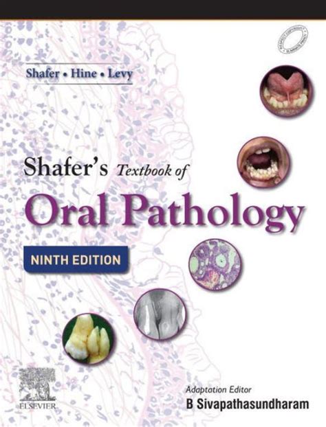 Shafer s textbook of oral pathology. - Ueber einen fall von sekundärem ovarialcarcinom ....
