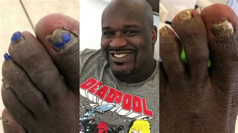 Shaq feet. May 29, 2015 ... But Shaq's old(ish) now, and old men have to take care of their bodies, especially if that body is the size of Mack Truck. According to a newly ... 