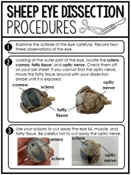 Sheep Eye Dissection Lab Answer Key