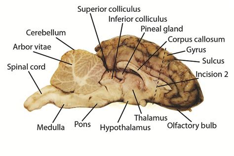 Sheep brain dissection guide answers for anatomy. - Conferencias sobre dos admirables instituciones cientificas britanicas.