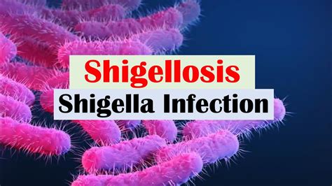 Shigella and Shigellosis