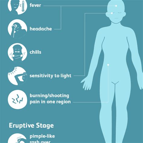 Shingles symptoms: 4 key signs that are different from ... - Express