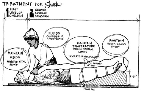 Shock: What Causes It and What To Do - NOLS