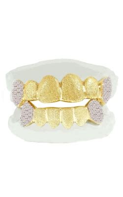 Shop Custom Diamond Grills at Highline Custom Jewelry