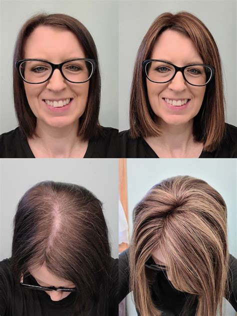 Short Hair Toppers for Thinning Hair: A Comprehensive Guide