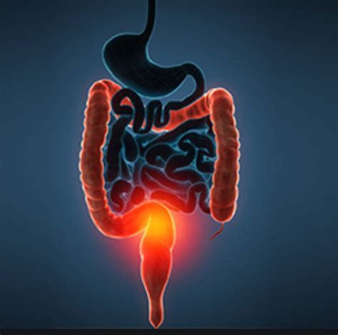 Short-course radiotherapy followed by chemotherapy before TME in