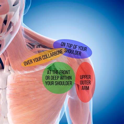 Shoulder Pain Diagram Diagnosis Chart Shoulder Pain Exp