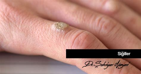 Siğil Şehriyar Nazari. 