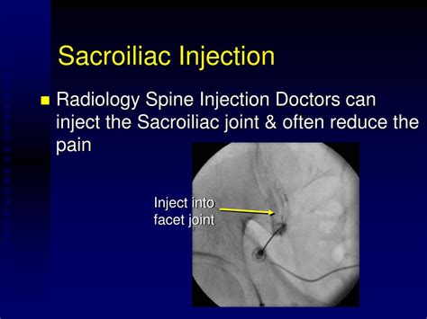 Sacroiliac joint injections may be performed unilateral or bilateral in the same session. For professional services performed by the physician and billed on a CMS 1500 or electronic equivalent: Bilateral SIJIs procedures reported with CPT 27096 or 64451 should be reported with modifier 50. If a unilateral joint injection (CPT 27096) is ...