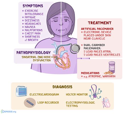 Sick Sinus Syndrome Symptoms, Treatment, & Prognosis Buoy