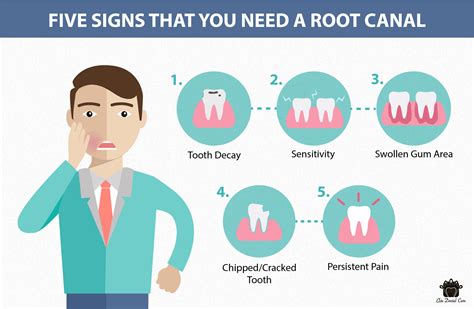 Signs You Need a Root Canal Treatment