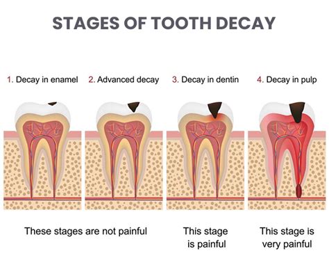 Signs Your Teeth Aren