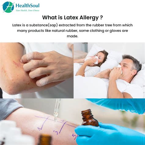 Signs and symptoms of latex allergy - Latex Allergy Symptoms: What You  Should Be Aware Of