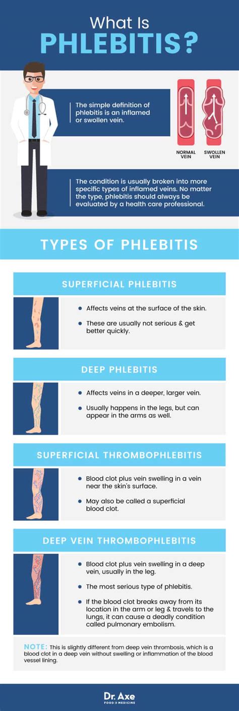 Phlebitis (superficial thrombophlebitis) - NHS