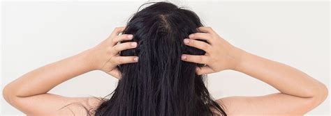 SignsandSymptomsofaSensitiveScalp