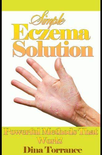 Simple eczema solution eczema treatment guide book 1 kindle edition. - Michelin guide new york city 2014 restaurants michelin guide michelin.