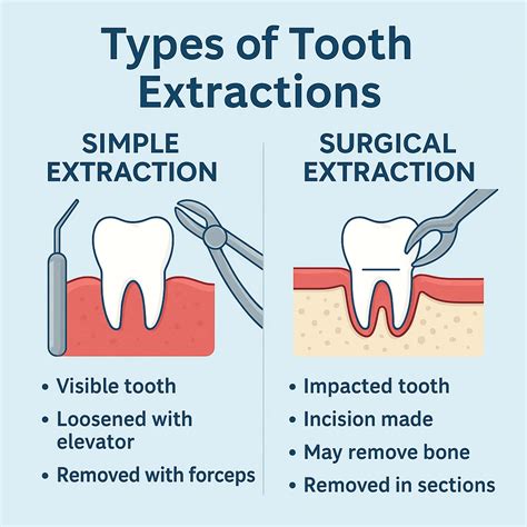 Simple extraction vs surgical extraction wisdom teeth.  Learn the key dif...