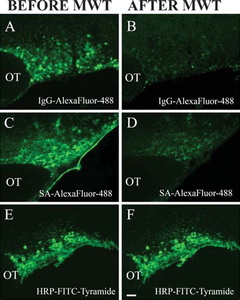 Simultaneous Visualization of Multiple Antigens with Tyramide …