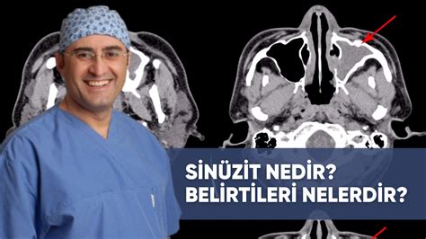 Sinüzit HarbiForum.