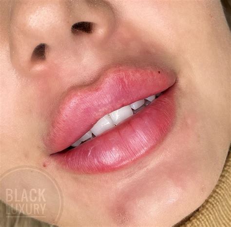 Sirenalips Onlyfans Leak (SEX) 🔥