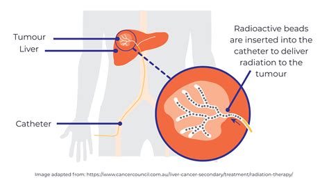 Sirt Halı ve Koltuk Yıkama