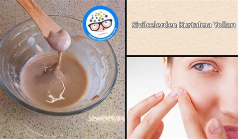 Sivilcelerden kurtulma yolları... 