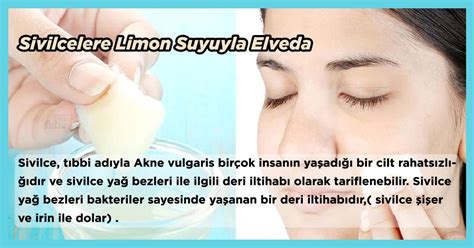 Sivilcelere Limon Suyuyla Elveda Medium.