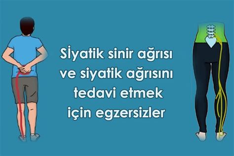 Siyatik Bacak Ağrısı Tedavisi.