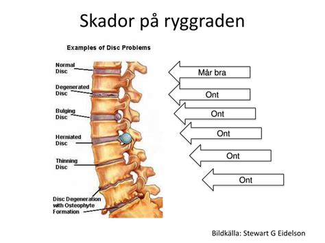 Skador p&aring; huvud och &ouml;gon - 1177