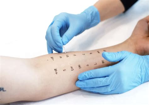 Skin Prick Testing - Diagenics Limited