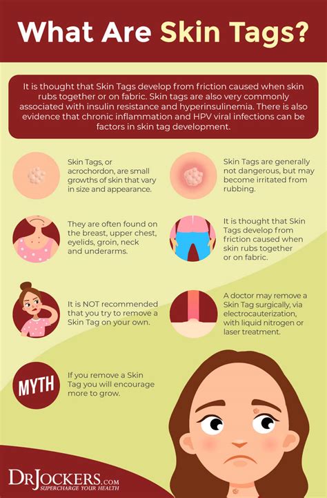 Skin Tags Major Causes and Natural Support Strategies