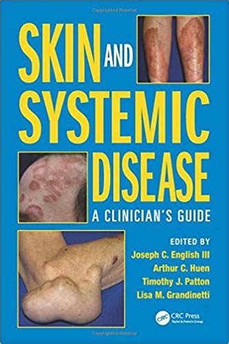 Skin and systemic disease a clinician s guide. - Analysing witness testimony a guide for legal practitioners and other professionals.