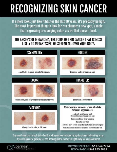 Skin cancer in people of color